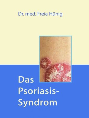 cover image of Das Psoriasis-Syndrom